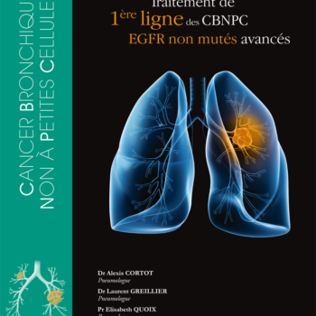 Traitement de 1ère ligne des CBNPC EGFR non mutés avancés