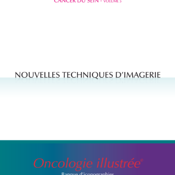 Cancer du sein - volume 5 : Nouvelles techniques d'imagerie